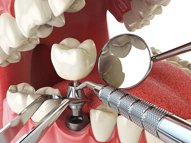 Best Emergency Cosmetic Dentistry in Port Jefferson, NY
